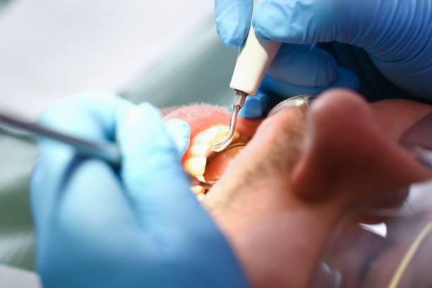 Best Emergency Treatment for Toothache in Plains, KS