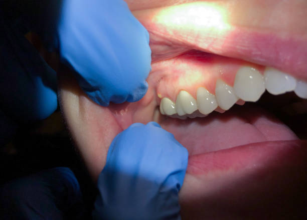 Best Emergency Broken Tooth Repair in Plains, KS