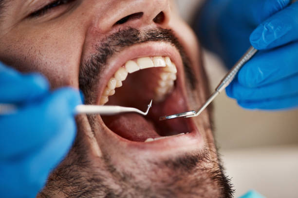 Professional Emergency Dentist in KS